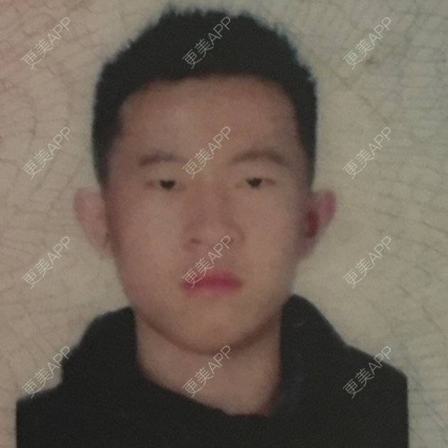 更美 - popo.t的口腔检查经验 | 口腔检查 | 武汉