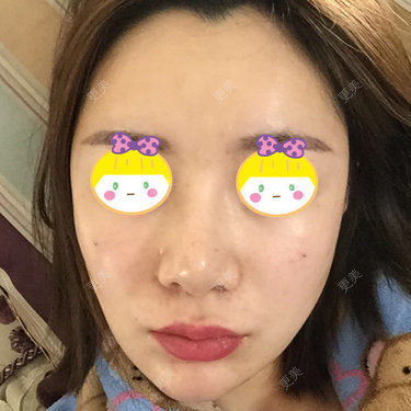 Vivian是一个瘦宝宝