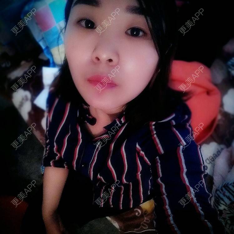 更美 - 小猪猪、的角膜接触镜矫正经验 | 眼部整形 | 角膜接触镜矫正 | 北京