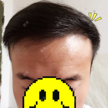 曾浩 医生