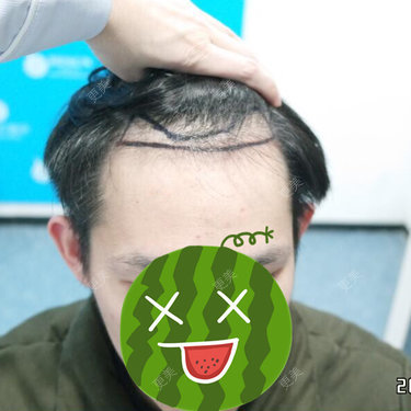 曾浩 医生