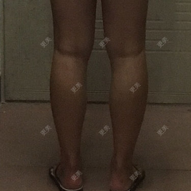 李小花妹妹