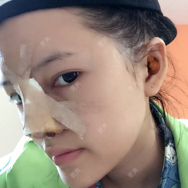 小雪碧儿