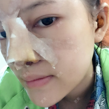小雪碧儿