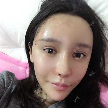 Jocelyn.T