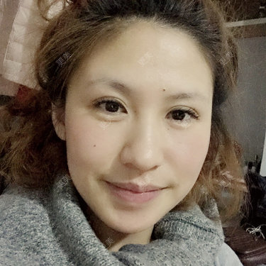 酒窝