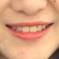 更美用户8876387759
