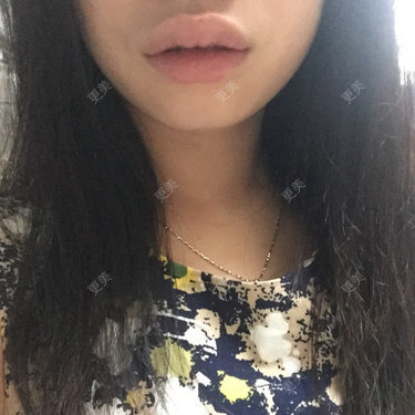 唇形