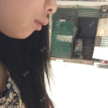 唇形