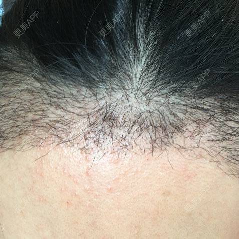 更美 - 琉璃玥的植眉经验 | 美购日记 | 南昌