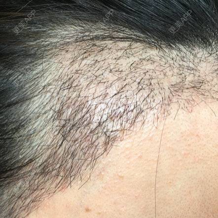 更美 - 琉璃玥的植眉经验 | 美购日记 | 南昌