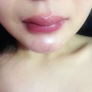 芳芳芳芳芳