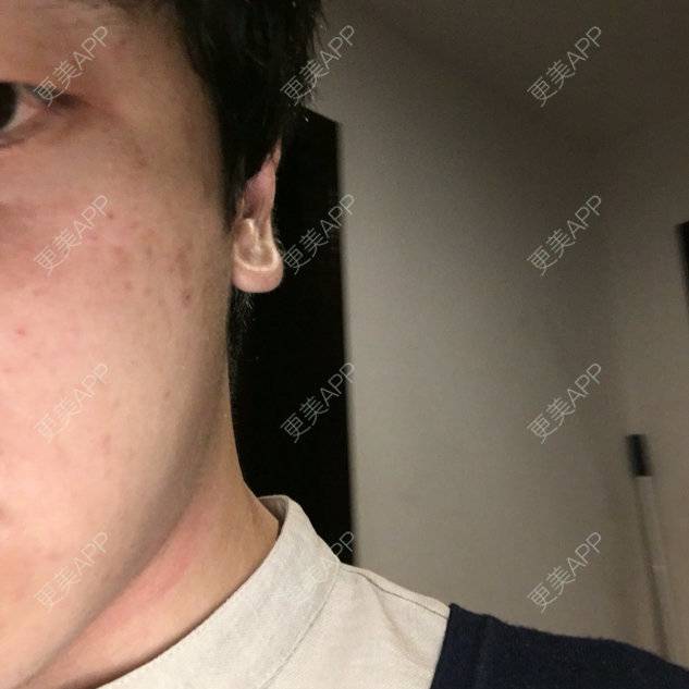 更美 - 青春、讓人想念讓人醉的经验 | 耳部矫正 | 杭州