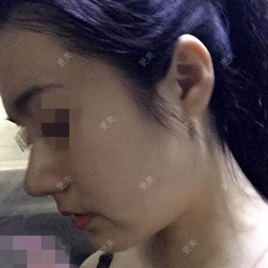偏执狂艾米米介雪瑶