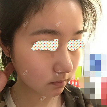 偏执狂艾米米介雪瑶