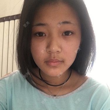 美肤最重要