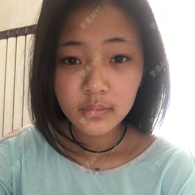 更美 - 美肤最重要的经验 | 乳晕漂染 | 天津