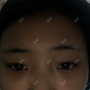 美肤最重要