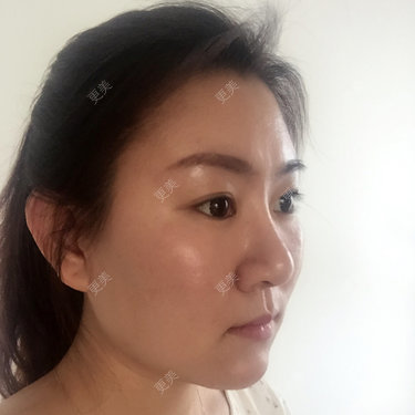 更美用户17UYHv42VB