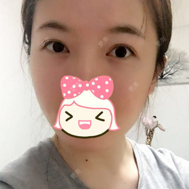 焦小宝