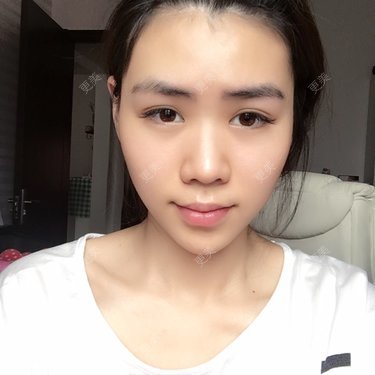 两颚