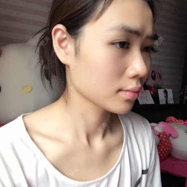 两颚