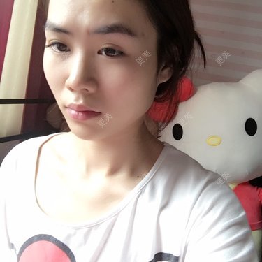 两颚