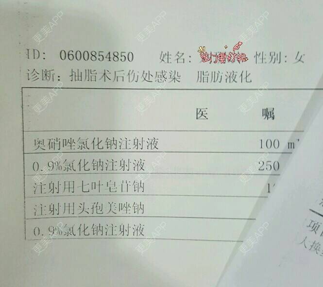更美 - 贪吃兔子的经验 | 大腿抽脂 | 美购日记 | 抽脂瘦小腿 | 郑州