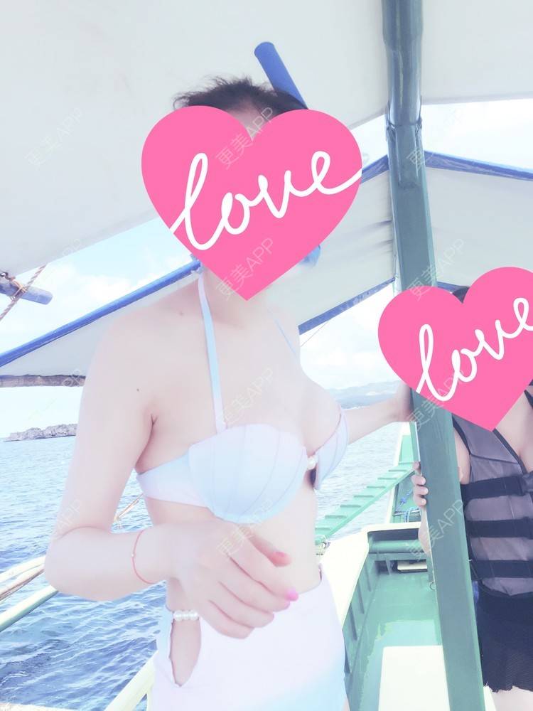 更美 - zxcmm的假体隆胸经验 | 美购日记 | 硅胶隆胸 | 假体隆胸 | 昆明