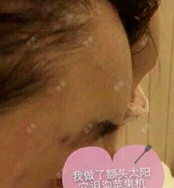 吃多饭