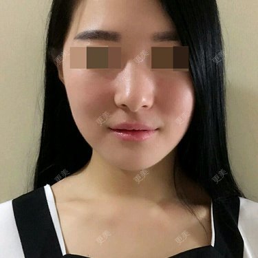 宋洋 医生