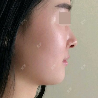 宋洋 医生