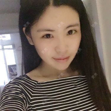 更美用户FXmylkYNhg