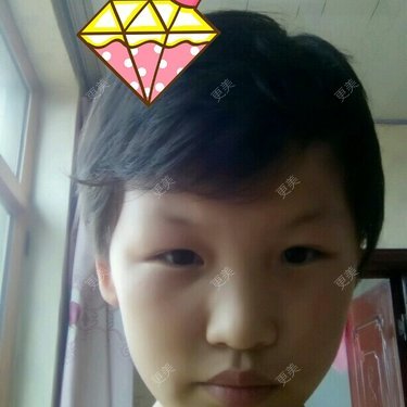 眼科其他