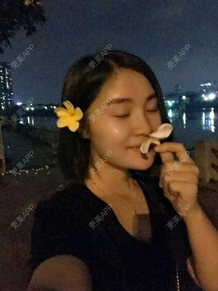 更美 - 倔强的石头的玻尿酸鼻部经验 | 玻尿酸隆下巴 | 玻尿酸鼻部 | 瑞蓝玻尿酸 | 东莞