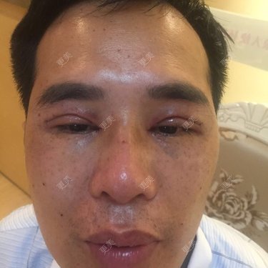 韦英鹏