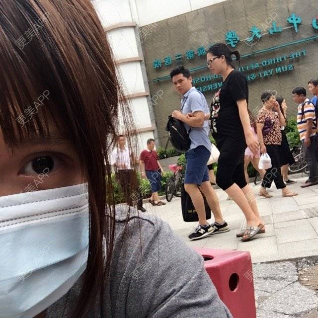 更美 - 养只兔吧的全切双眼皮经验 | 广州 | 去痘 | 全切双眼皮