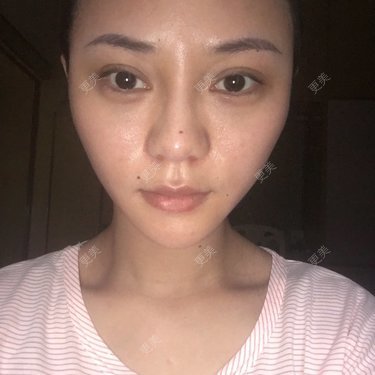 体检