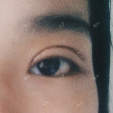 圈圈小恐龙