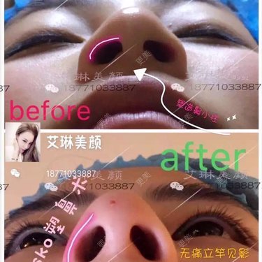 「∨、