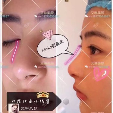 「∨、