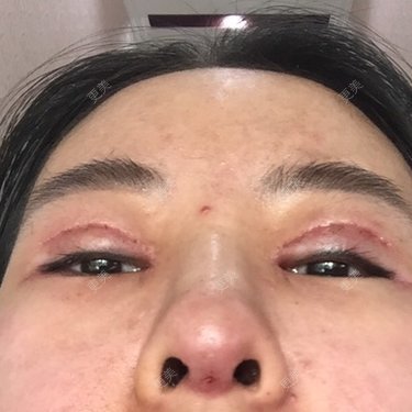 娃娃呀