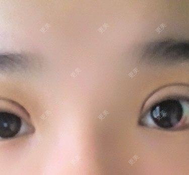 圈圈小恐龙