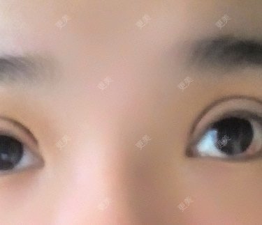 圈圈小恐龙