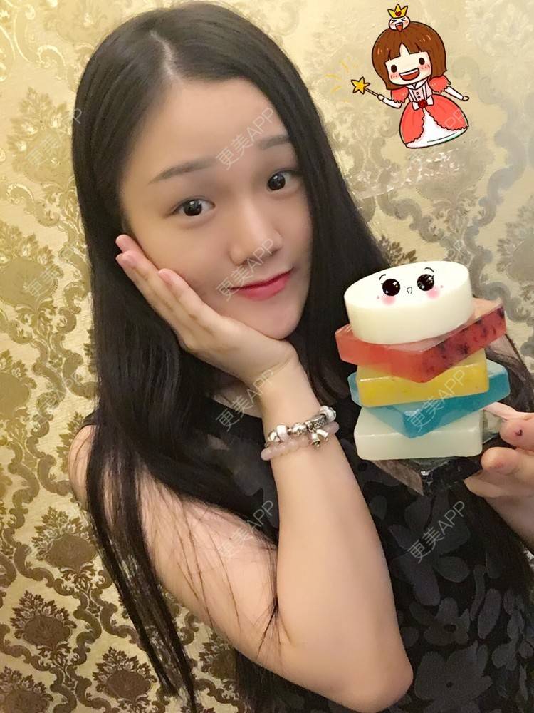 更美 - KrisIx💗。的祛疤痕痘印经验 | 美购日记 | 祛疤痕痘印 | 点阵激光1 | 深圳