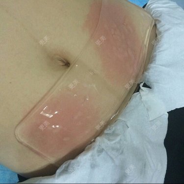 FRESKIN晶肤医疗美容（未央店）