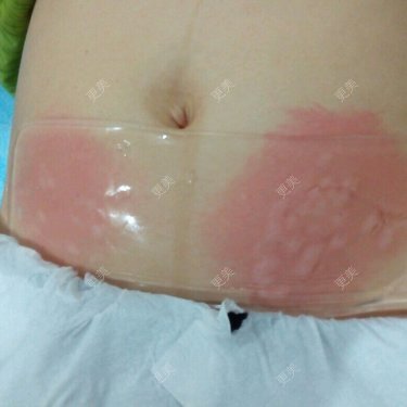 FRESKIN晶肤医疗美容（未央店）