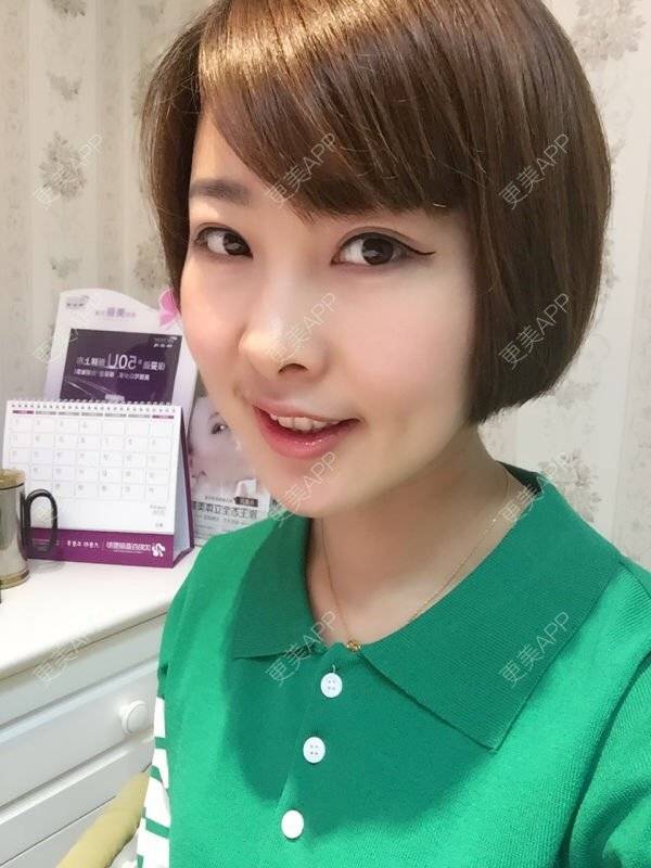 更美 - 张清学 医生的全切双眼皮经验 | 术后求抱抱 | 沈阳 | 全切双眼皮