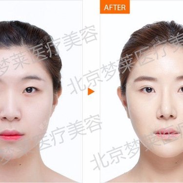 北京梦莱医疗美容诊所