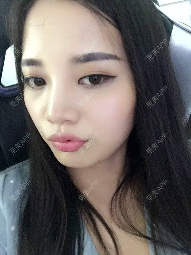 更美 - wu👙姑娘的经验 | 广州 | 矫正牙齿